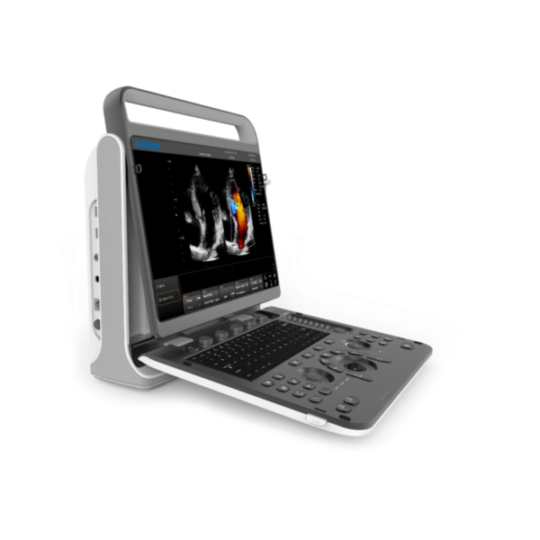 Аппарат УЗИ (сканер) Chison SonoTouch 60 Pro