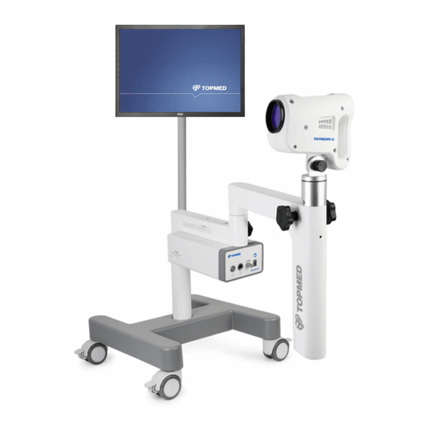 Видеокольпоскоп TOPMED Colposcope HD
